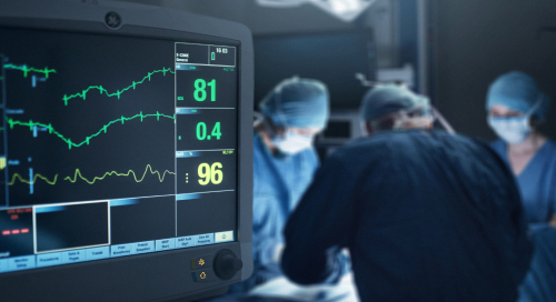How to Overcome Three of the Biggest Challenges in Medical Device Development
